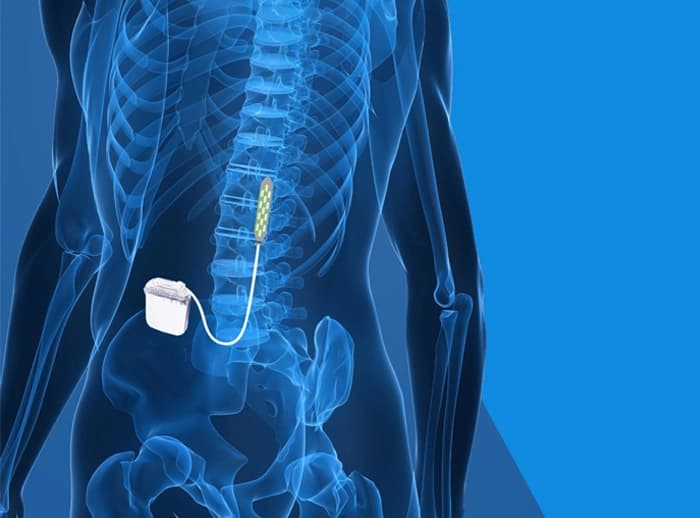 Automated Tools to Improve Spinal Cord Injury Outcomes with Epidural Stimulation